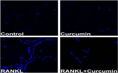 동조배양으로얻은파골세포에 RANKL을단독으로처리했을때와 curcumin을같이처리했을때 Akt와 ERK의인산화의변화는관찰되지않았다 (Fig 3A). 다음으로우리는세포사멸의생화학적특성중에하나인 caspase 활성에 curcumin의효과를검증하였다.