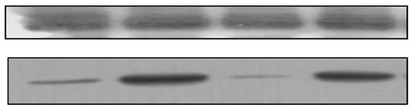 1396 이정윤 안연주 김지원 최효경 이유현 A β-ctin 요 약 B 4-Nitroctechol (μmol/μg protein) 3 2 CYP2E1 EtOH - + + + AK - - 2 c Control EtOH EtOH+AK2 EtOH+AK Fig. 4. Effects of Angelic keiskei on protein expression nd enzyme ctivity of CYP2E1 in ethnol-induced mouse liver.