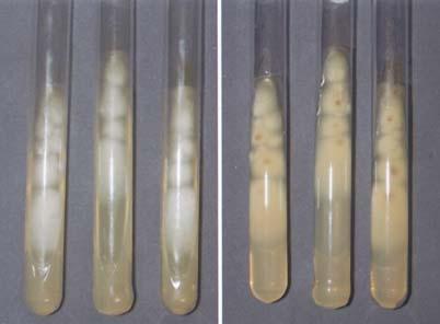 Several, rapid-growing, whitish cottonly colonies on Sabouraud's dextrose agar slants for 3 days at 37. 고찰 Fusarium에의한감염증은드물게나타나는질환으로면역저하자에서기회감염을유발하는원인균으로증가하는추세이며, 때때로면역저하자가아닐경우에도감염되는경우도있다 1.