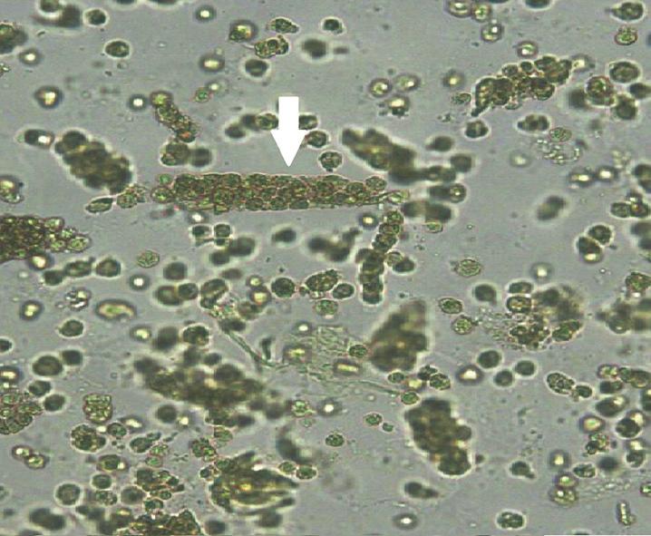 A B C D Fig. 1. Images of urine sediments (with arrow) for the external quality assessment. (A) CUI-16-01 sulfadiazine crystal (original magnification 400).