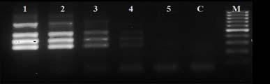 PCR 법을이용한 St. aureus, Sal. enterica subsp., V. parahaemolyticus 의다중동시검출 599 mer set 구성임을확인할수있었다. Singleplex 및 multiplex PCR 방법에의한 genomic DNA 의검출한계 S. aureus, S. enterica subsp., V. parahaemolyticus 세식중독원인균주에서분리정제되어진 genomic DNA의농도에따른검출한계를확인하고자정제되어진 DNA를 10배단계희석하여 singleplex PCR 반응결과를조사하였다.