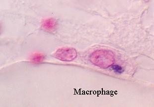 histiocyte) - 중추신경계의 microglial cell - 간의 Kupper's cell