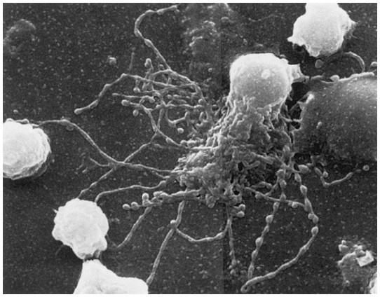 6) 수지상세포 (dendritic cell) 세포돌기 (dendrite)