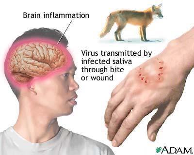 11) 광견병 (rabies)
