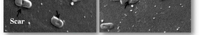 (A) Untreated E. coli XL-1; (B) treated E. coli XL-1; (C) treated after 12 hrs; (D) treated after 24 hours under 20,000 X magnification.