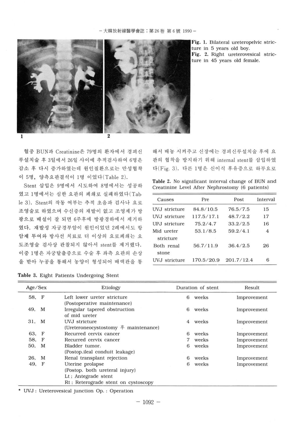 大韓放射線뽑學會誌 : 第 26 卷第 6 號 1990-1. Bilateral ureteropelvic stricture in 5 years old boy. Fig. 2. Right ureterovesical stricture in 45 years old female.