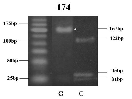 채취된협점막상피표본에 50 mm NaOH 200 μl 을첨가하여 5분간 95 C로가열하고, 20 μl Tris buffer(ph 8.0) 로중화시켜 genomic DNA를얻었다 5). 4.
