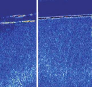 14 J Korean Acad Oral Health 2014;38:10-16 Fig. 3. Images taken by blue light of QLF-D over demineralization time.