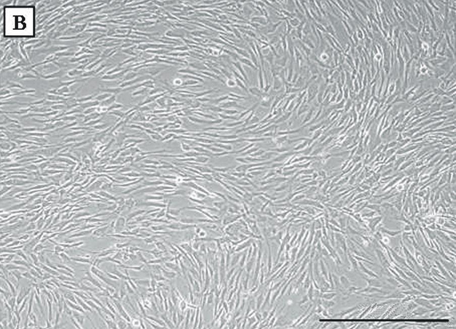 지방세포 분화는 유도 배양액 (DMEM (Cel- 사용하였으나, 단일 세포 배양 시 세포 증식이 잘 되지 lgro)에 1μM Dexamethasone, 0.5 mm 3-iso- 않아 두 종류의 간엽줄기세포군에서는 실험에 사용할 정 butyl-1-methylxanthine, 0.