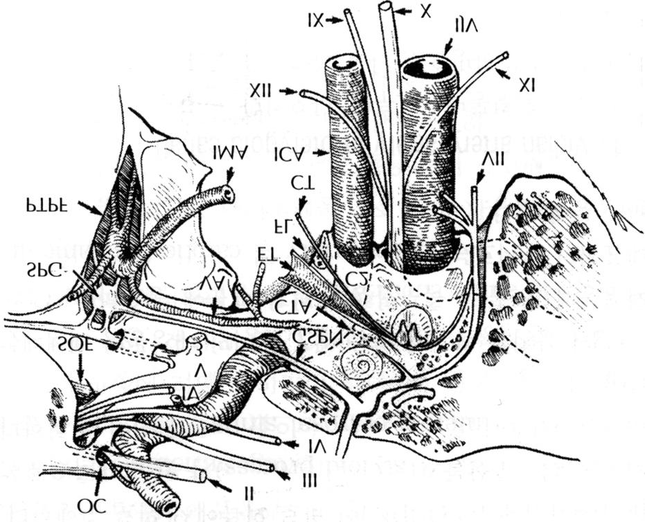 Fig. 3. Anatomic diagram depicting the embryologic carotidbasilar and carotid-vertebral anastomoses.
