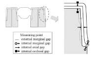 외부변연간격 (external marginal gap): 다이변연에서하부구조물변연까지의최단거리 내부변연간격 (internal marginal gap): 변연부의치은면에서하부구조물내면까지의최단수직거리 Fig. 2. Measuring points for marginal and internal gaps.