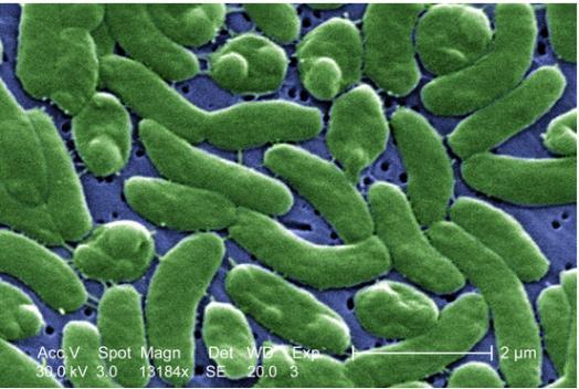 Special Issue 비브리오패혈증 (Vibrio vulnificus sepsis) 1.