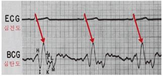를이용한맥박측정기능도화상처리기술을응용한것으로추정 가속도센서를활용한심박측정기술은체중계형기기에올라서는것만으로심박을측정하는데, 심탄도 (BCG) 에주목하는것이특징 - 심탄도 (ballistocardiogram: BCG) 는심장의물리적움직임에따라생기는약간의몸의움직임을전기적으로기록한것으로서심장이박출한혈액의운동량을나타내며, 심전도에비해조금늦게피크가나타나는것이특성