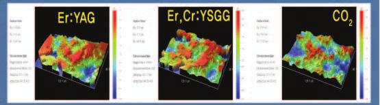 Surface composition analysis (EDAX Analyzer)