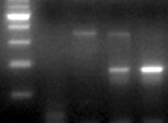 인트론 2 분석을통한 RhC/c 혈액형의판정 5. 엑손 2 의 307 번염기와인트론 2 삽입부위분석 ( 방법 2) 시험관에추출한 DNA 7μL (50 ng/μl) 을넣고, Taq polymerase (TaKaRa, Shiga, Japan) 0.25 μl, dntp (2.