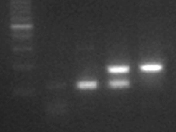 PCR은 PTC- 200 (MJ Research, Waltham, USA) 를사용하여 95 o C 에서 3분간처리한다음 95 o C에서 30초, 60 o C에서 30초, 72 o C에서 30초씩 40회증폭하고, 마지막에 72 o C에서 5분간항온시켰다.