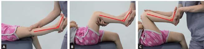 무릎을굽힘시켰을때, 발목의발등굽힘이잘된다면가자미근의단축은없는것임 (B). 다시무릎을폄시켰을때, 장딴지근의경직이나구축에의해저항이발생 (C).