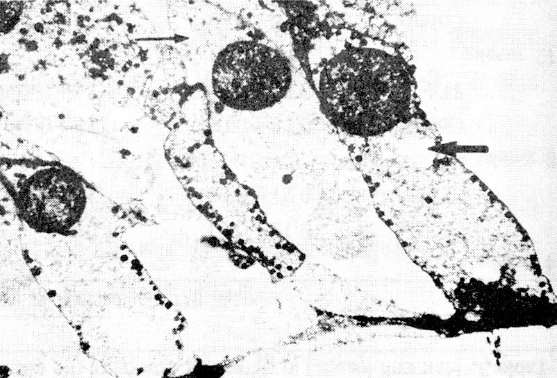 Fig. 4. Transmission electron micrograph of the first turn of the cochlea at the diabetic group of the 16th week.