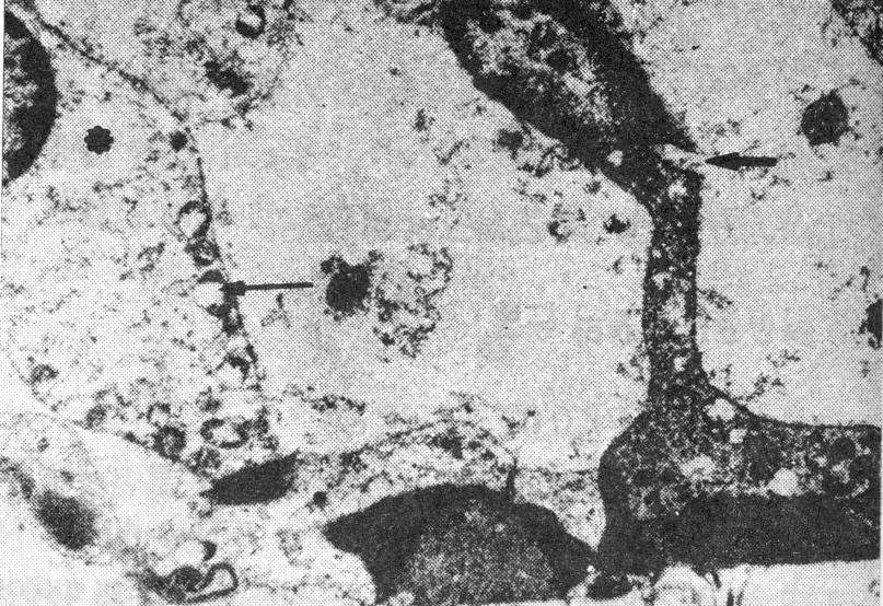 Transmission electron micrograph of the outer hair cell in the first turn of the cochlea at the control group of the 16th week.