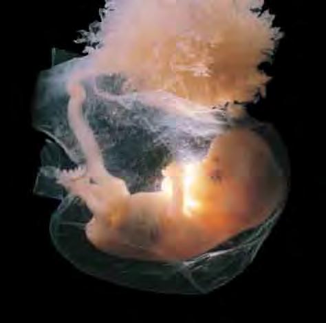 임신은그시점에서 260일간계속됩니다. 배아는태아막으로둘러싸여양수에떠있는데탯줄과태반으 로모체와연결되어혈액을공급받습니다. 처음 4주동안태아의크기는약4mm 정도이며, 8주가될때까지길이는 3cm, 무게는 4g으로성장하고, 모든장기가형성됩니다.