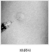 백신접종방법 1 접종방법이나부위가잘못된경우 : 충분한예방효과가생기지않거나이상반응발생증가 근육주사 피하주사 피내주사 대상포진 4 결핵 ( 피내용 ) Tdap B 형간염 /A 형간염 Tdap/Td a 인플루엔자 ( 사백신 ) HPV 백신 2,3, b MMR c 일본뇌염 수두 a :