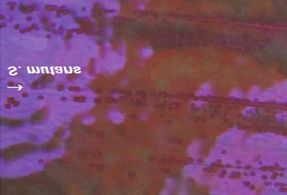 nucleatum culti vated on TSA blood media.