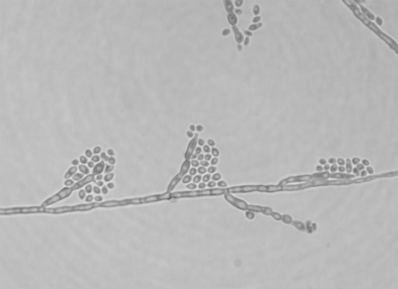 Round to ovoid, pale brown conidia accumulated in balls or slipped down the side of conidiophores (Lactophenol cotton blue stain, 400). 0.125μg/mL, caspofungin 2μg/mL, micafungin 8μg/mL이었다.