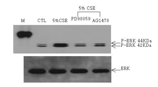 유전자의전사가억제되는지 luciferase 활성도를통하여관찰하였다. 담배연기추출물자극시증가된 Muc5ac 유전자의전사는이들억제제에의하여모두억제되었다 ( 그림 4).