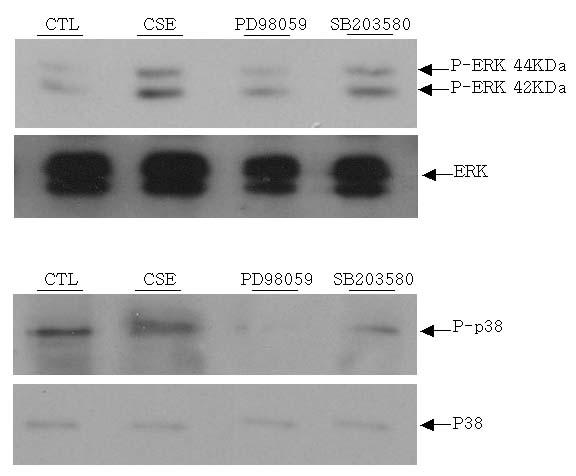 Tuberculosis and Respiratory Diseases Vol. 58. No. 6, Jun. 2005 Figure 6. Reverse transcription polymerase chain re action (RT-PCR) analysis of Muc5ac mrna expression in A549 cells.
