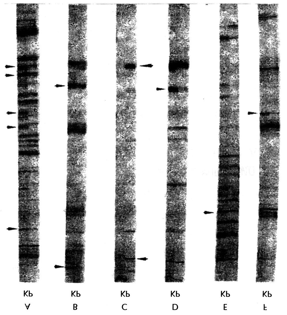 결과 1. DD-PCR과 DEST의선택 2. DEST의획득과재증폭 3. DEST의클로닝과염기서열결정및분석 Fig. 1. Differentially expressed mrnas between in PC12 cells and A123.7 cells. The total RNAs were purified from A123.7 cell and PC12 cell.