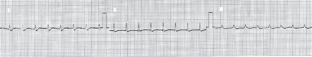 전체 심전도 유도에서 심전 ꠚꠚꠚꠚꠚꠚꠚꠚꠚꠚꠚꠚꠚꠚꠚꠚꠚꠚꠚꠚꠚꠚꠚꠚꠚꠚꠚꠚꠚꠚꠚꠚꠚꠚꠚꠚꠚꠚꠚꠚꠚꠚꠚꠚꠚꠚꠚꠚꠚꠚꠚꠚꠚꠚꠚ Heart rate (PM) QRS size (mm) ꠏꠏꠏꠏꠏꠏꠏꠏꠏꠏꠏꠏꠏꠏꠏꠏꠏꠏꠏꠏꠏꠏꠏꠏꠏꠏꠏꠏꠏꠏꠏꠏꠏꠏꠏꠏꠏꠏꠏꠏꠏꠏꠏꠏꠏꠏꠏꠏꠏꠏꠏꠏꠏꠏꠏ Pre-ligation 277.6±40.3 3.6±3.