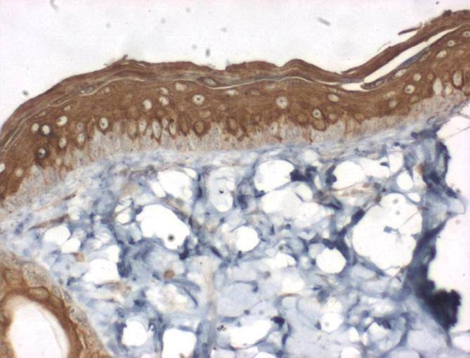 Immunohistochemistry for CD31. Expression of CD31 is present in endothelial cells in 7 days after burn. 8) CD31 의발현 (Fig.