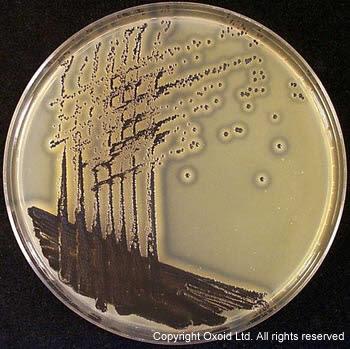 Staphylococcus aureus Mannitol