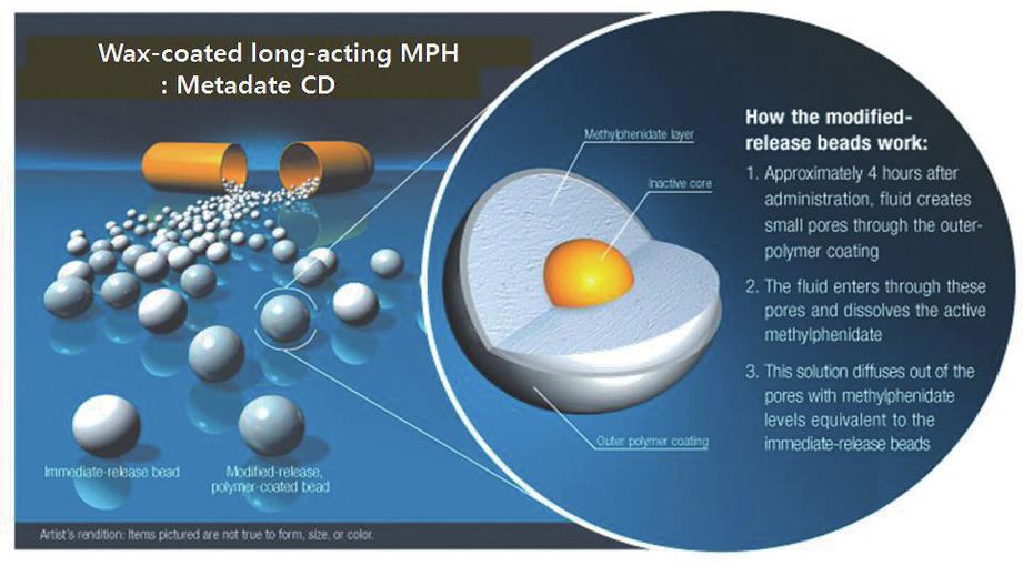 A : smotic releasing technique-based ER MPH (Concerta R- S ). B : Wax-coating granule-based ER MPH (Metadate CD, Medikinetretard ). C : Plasma concentration of MPH medications.