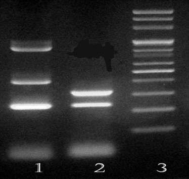 M, 100-bp DNA size marker; Lane1, B. cereus ATCC 13061; Lane 2, B. cereus KCTC 1014; Lane 3, B. cereus ATCC 12480; Lane 4, B.