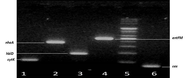 그림 3.6 구토및설사관련특정유전자 5 종류에대한 2nd set of primers 에대한 PCR 결과.
