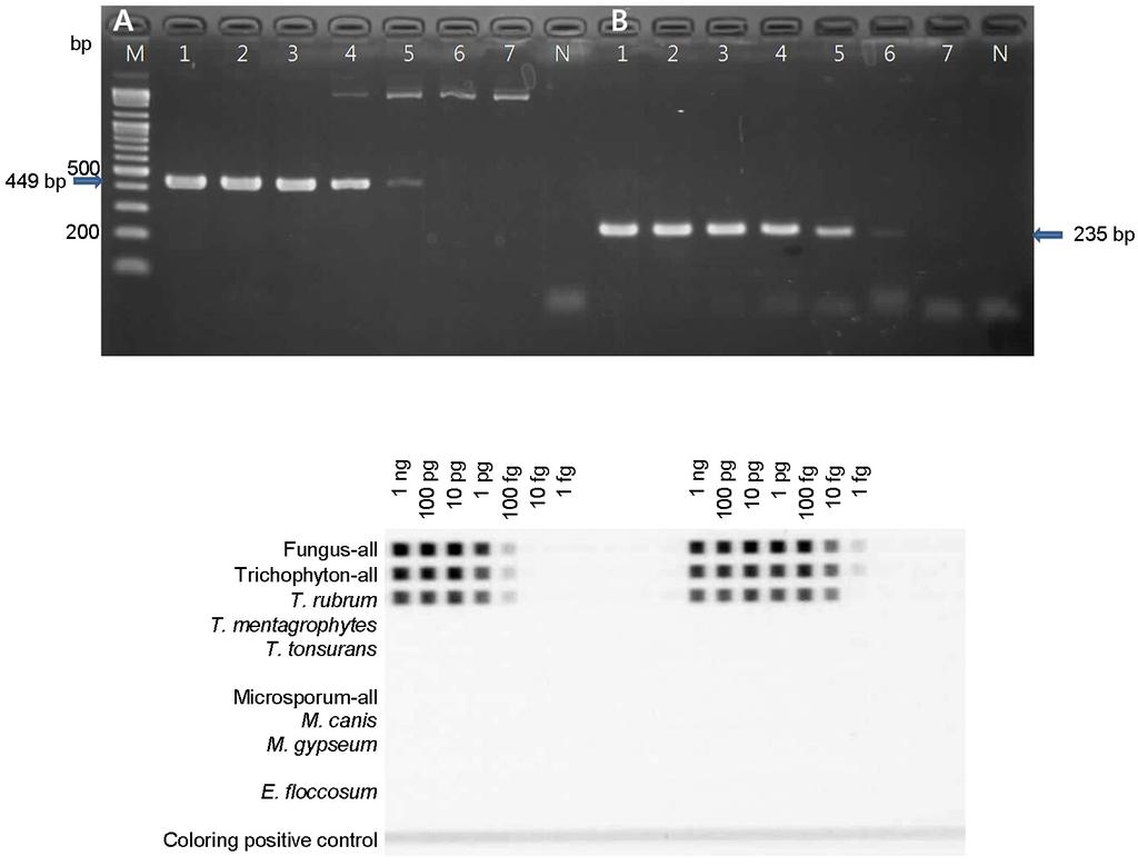 C D Fig. 1. Comparison of PCR-REBA sensitivity. (A) Using serially diluted T. rubrum DNAs for Bergmans' PCR. (B) Using serially diluted T. rubrum DNAs for PCR in this study.