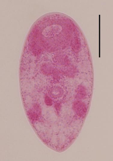 Sohn et al.: Metacercariae in clams and oysters from the west coast, Korea 405 Table 7. Dimensions a of Parvatrema sp.