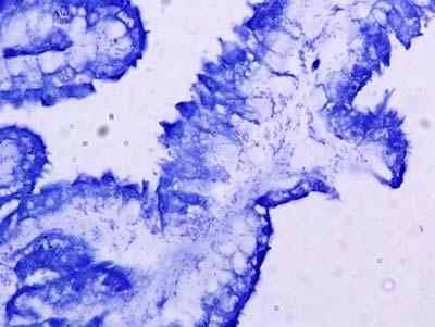 Korean Soc. Clin. Lab. Sci. 39(3):223-230, 2007 Fig. 2. H. pylori stained with blue color by Giemsa stain in surface epithelium of gastric mucosa. 400.