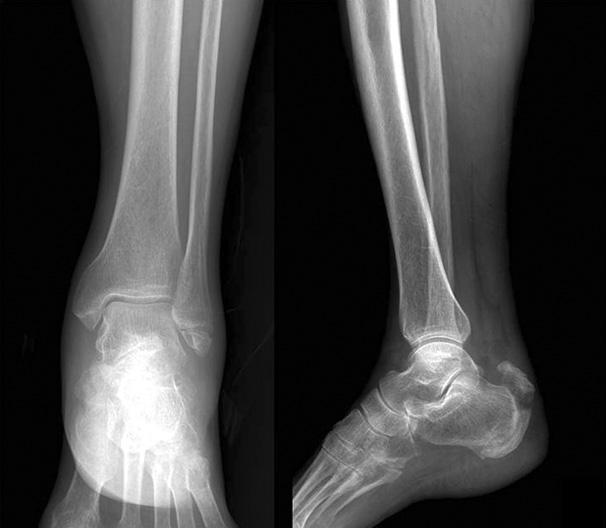 tubercle (B). Fig. 6.