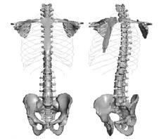 , 76867 (shell elements)782 (beam elements) (kinematic joint element) 6,, - S, in-vitro (rib cage) Fig 1 Normal 3-Dimensional Spine Finite