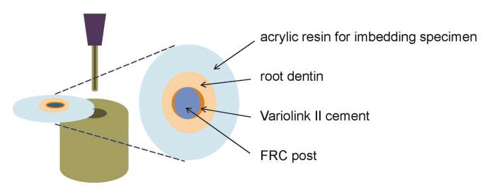 FRC post 는레진시멘트와근관상아질의접착에의해유지력을얻게되며, 재료사이의접착계면 (dentin/resin cement, resin cement/frc posts) 의적절한접착에의해유지된다.