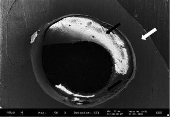 실패양상분석 접착강도측정후파절된시편을광학현미경으로관찰하였을때, 대조군에서는레진시멘트와의접착계면실패양상 (90%; adhesive failure with post) 이주로나타났으며, M