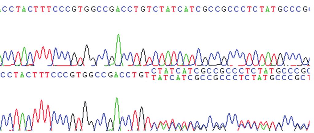 174 Kim MJ, et al. Contorl Proband Fig. 4. Sequencing of exon 1 in the MEN1 gene showed a frameshift mutation caused by deletion at nucleotide c.251(p.ser84 LeufsX35).