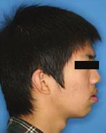 유성훈, 최혜영, 유형석, 백형선, 차정열 Pre-DO Post-DO 1Y-Follow up Post-treatment Figure 5.