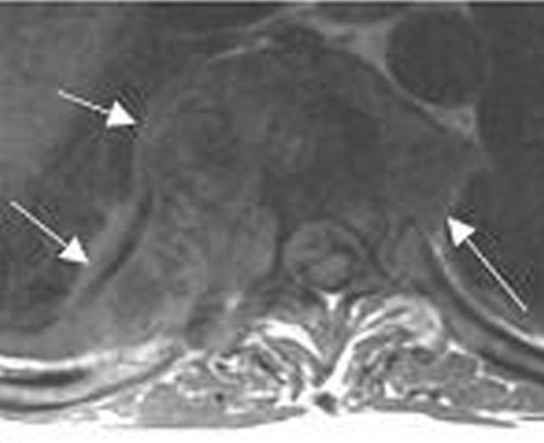 Axial T1-, T2-, and contrast-enhanced T1-weighted images show
