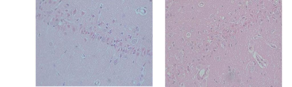days after transient forebrain ischemia The viable cells stained with hematoxylin