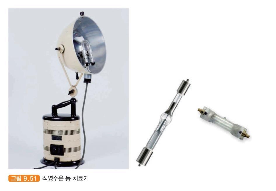 자외선치료의종류 수은증기램프 mercury vapour lamp 석영으로된유리관안에액체금속인수은이내장되어있으며,
