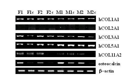 A. B. Figure 8. Effect of conditioned medium on the expression of hcol1a1, hcol2a1, hcol3a1, hcol5a1, hcol11a1, and osteocalcin mrna in hlf cells. A.