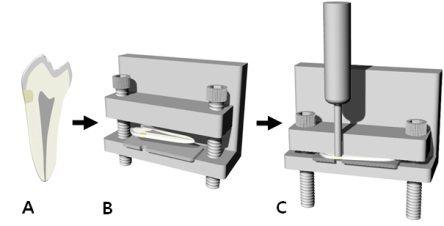 Figure 6. Schematic illustrations of the push-out shear bond test. (A) A vertically sectioned sample (B) was placed on the metal plate with a same sized proximal cavity.